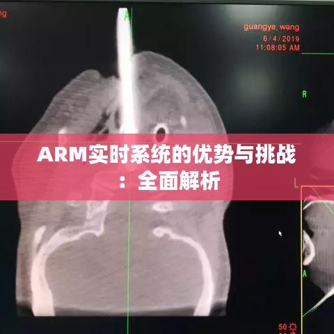 ARM实时系统的优势与挑战：全面解析