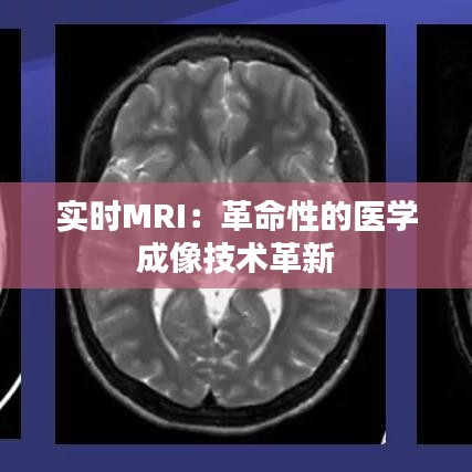 实时MRI：革命性的医学成像技术革新