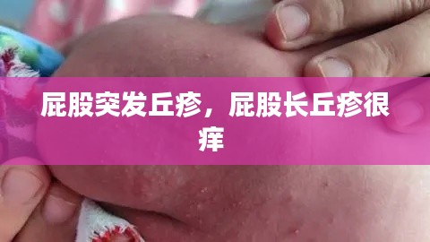 屁股突发丘疹，屁股长丘疹很痒 