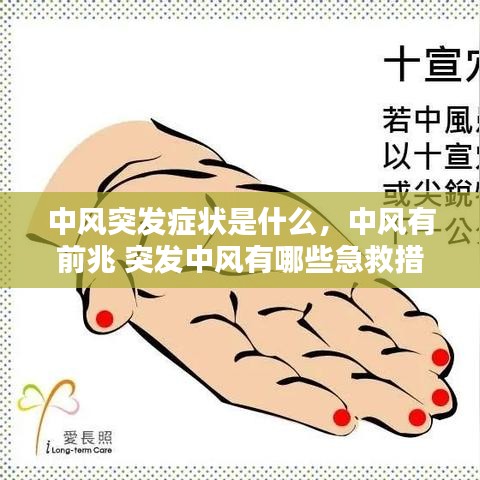 中风突发症状是什么，中风有前兆 突发中风有哪些急救措施 