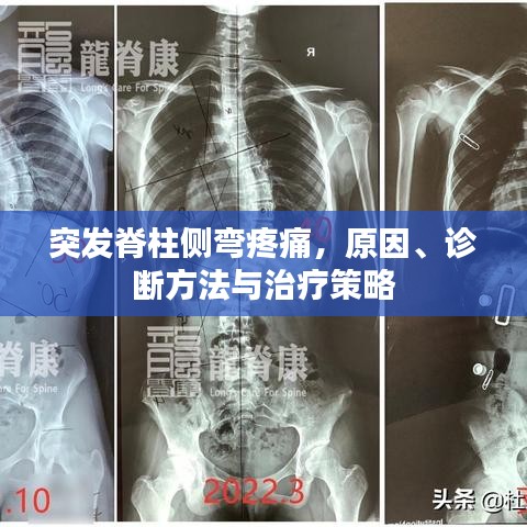 突发脊柱侧弯疼痛，原因、诊断方法与治疗策略