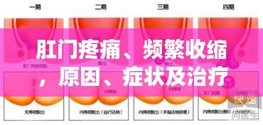 肛门疼痛、频繁收缩，原因、症状及治疗方法解析