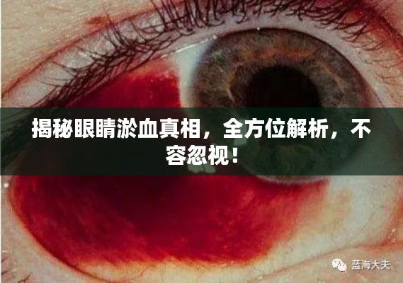 揭秘眼睛淤血真相，全方位解析，不容忽视！